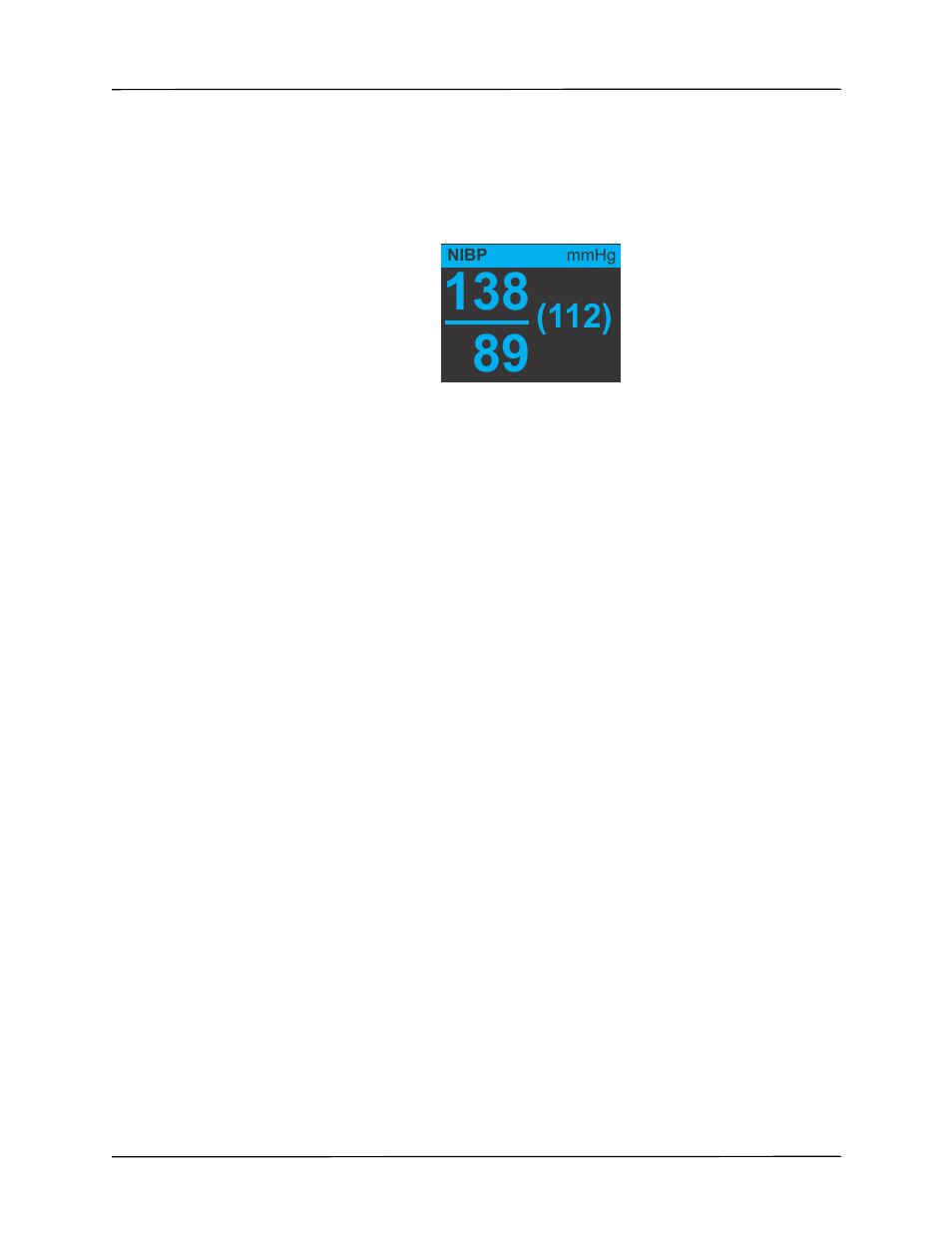 The nibp numeric display, Nibp setup and use | ZOLL Propaq M Rev B User Manual | Page 85 / 170