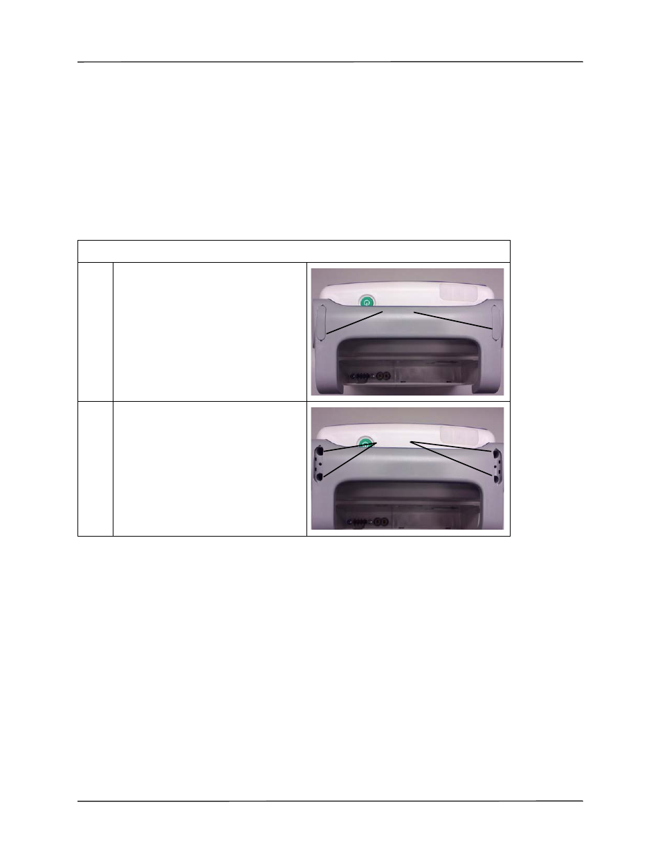 Removing the handle | ZOLL Propaq M Rev A User Manual | Page 47 / 78