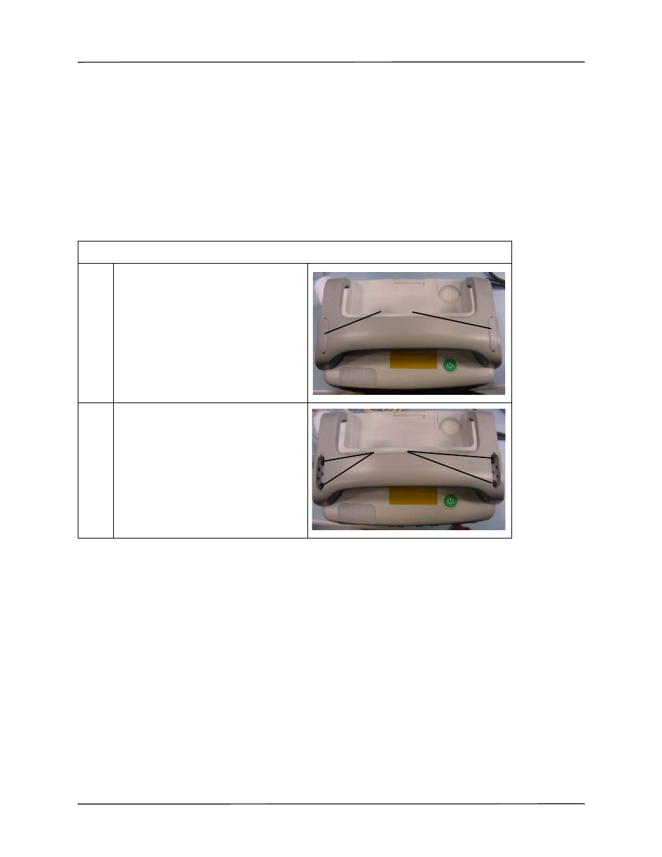 Removing the handle | ZOLL Propaq MD Rev B User Manual | Page 61 / 100