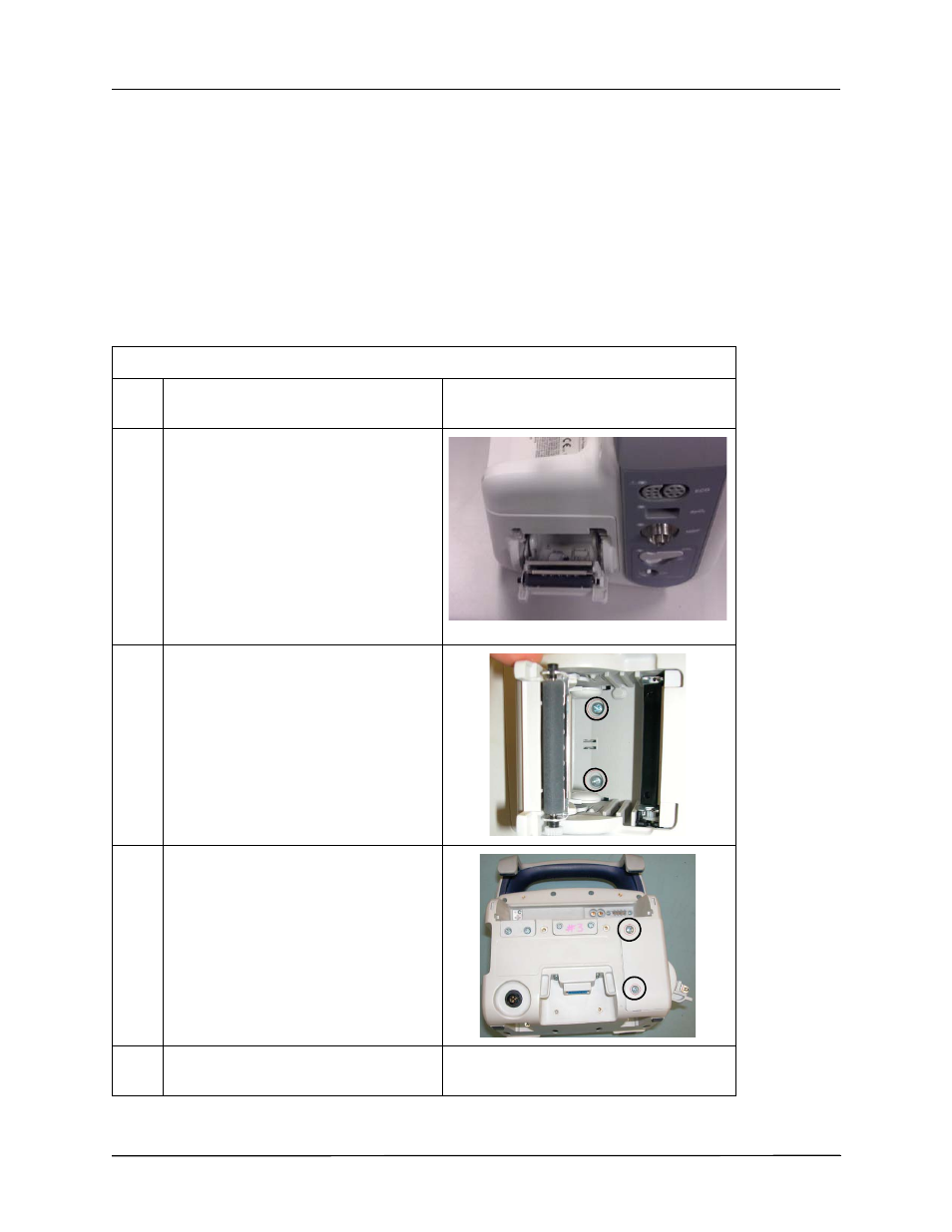 Removing the printer module | ZOLL Propaq MD Rev B User Manual | Page 62 / 100