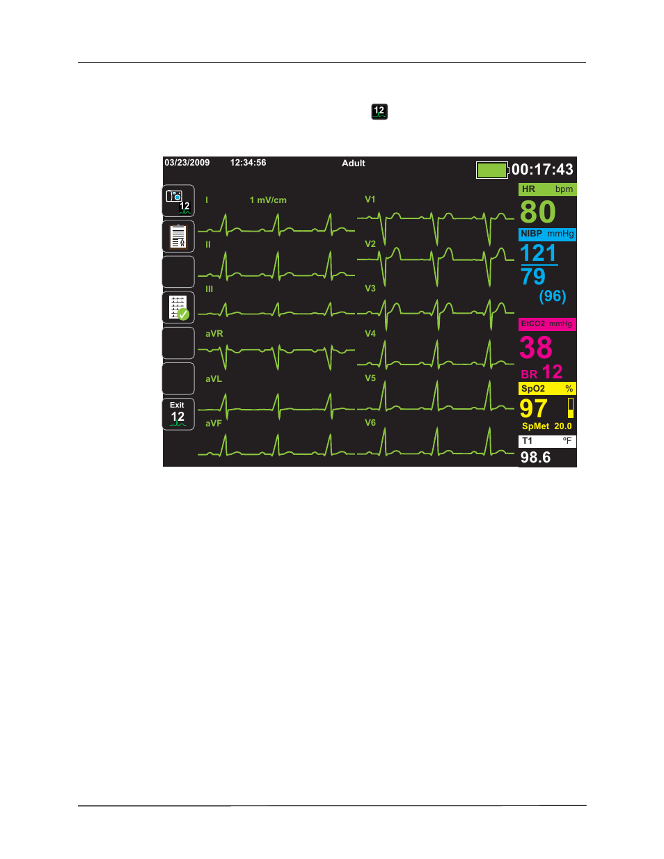 Observing the 12-lead waveform traces | ZOLL Propaq MD Rev A User Manual | Page 158 / 238