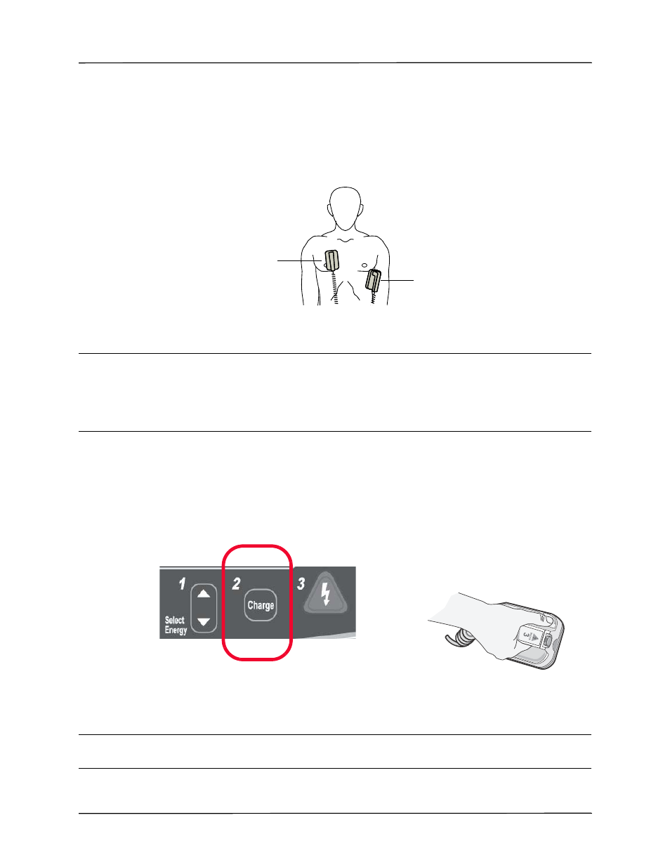 2 charge defibrillator | ZOLL Propaq MD Rev A User Manual | Page 165 / 238