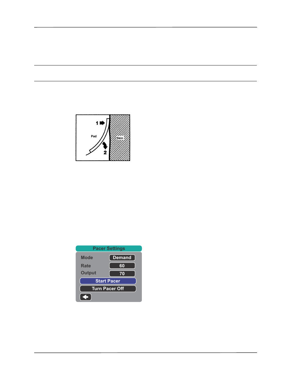 3 press pacer button, 4 set mode | ZOLL Propaq MD Rev A User Manual | Page 179 / 238