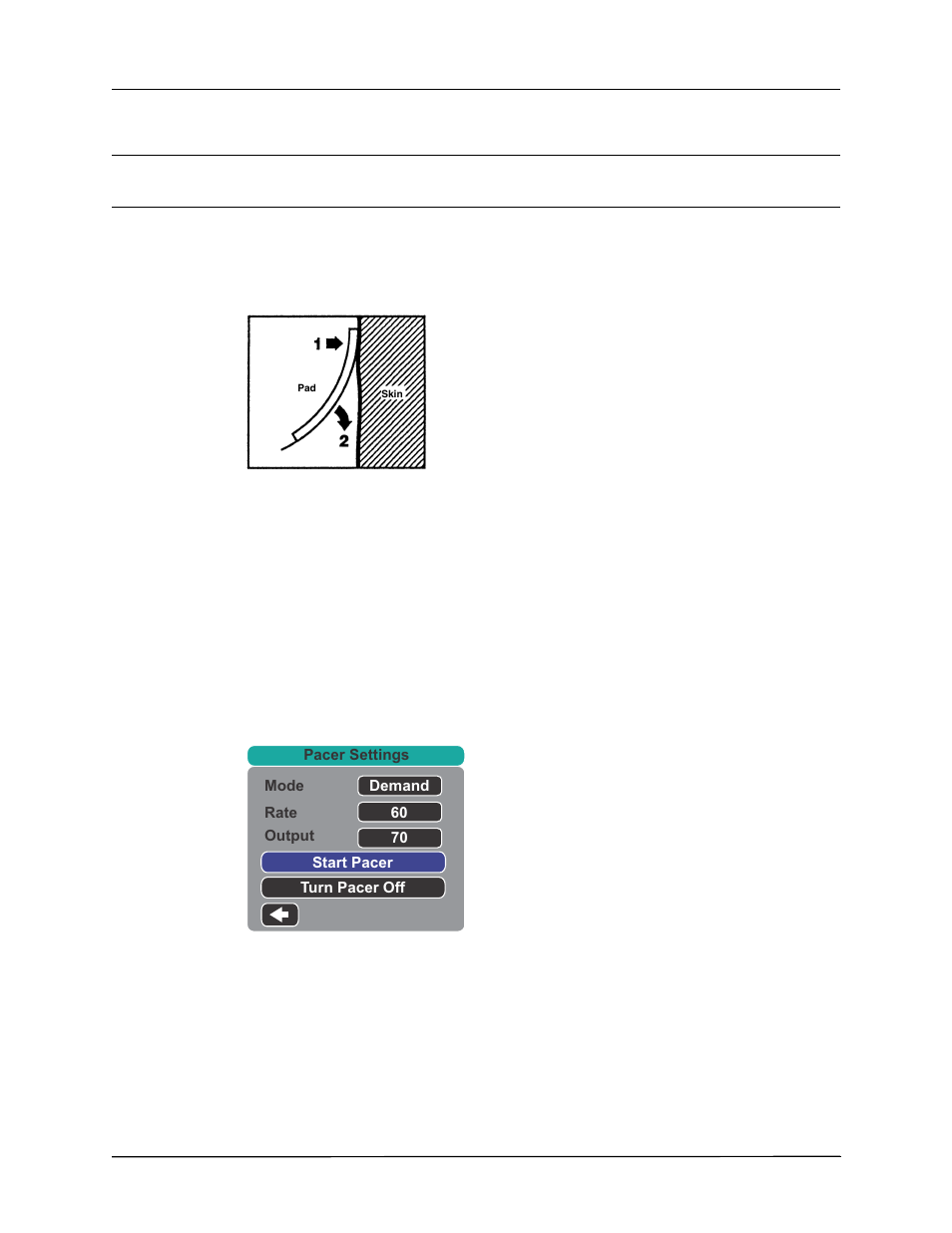 3 press pacer button, 4 set mode | ZOLL Propaq MD Rev A User Manual | Page 182 / 238