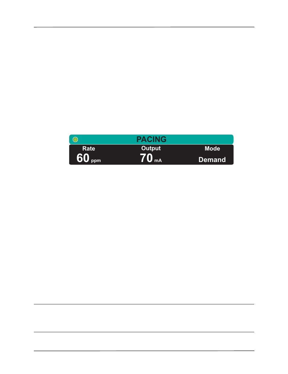 Pacing | ZOLL Propaq MD Rev A User Manual | Page 183 / 238