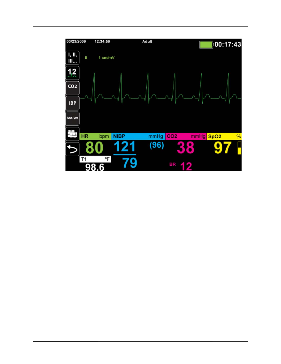 ZOLL Propaq MD Rev A User Manual | Page 58 / 238