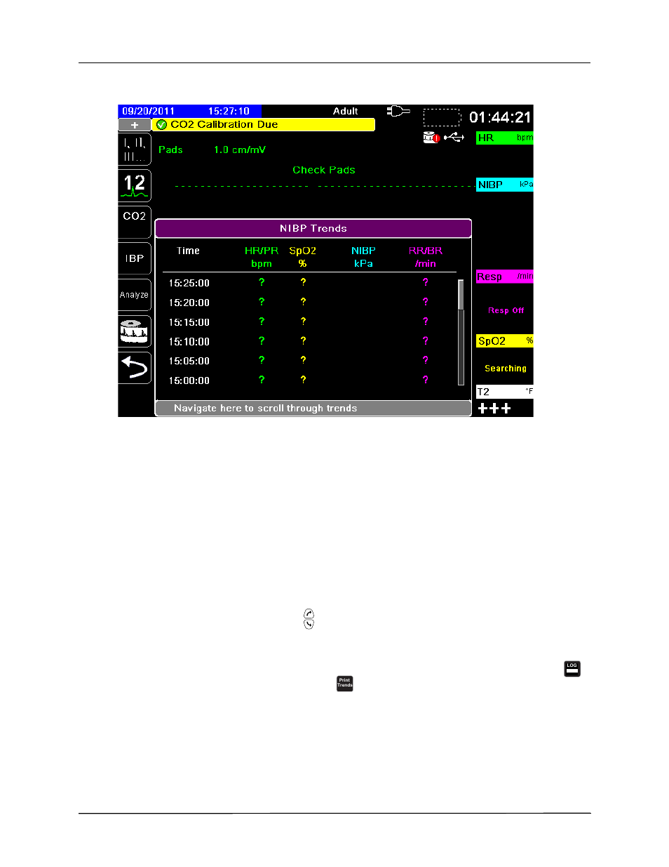 Displaying and printing trend information | ZOLL Propaq MD Rev A User Manual | Page 66 / 238