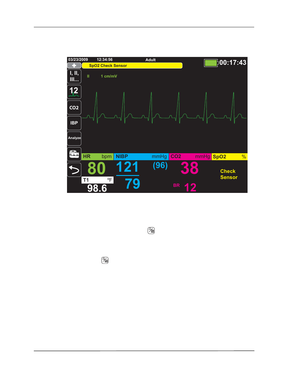 Responding to active alarms -- silencing the alarm | ZOLL Propaq MD Rev A User Manual | Page 72 / 238