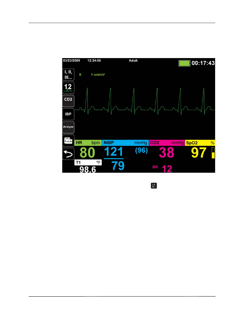 Selecting ecg waveforms for display | ZOLL Propaq MD Rev A User Manual | Page 84 / 238