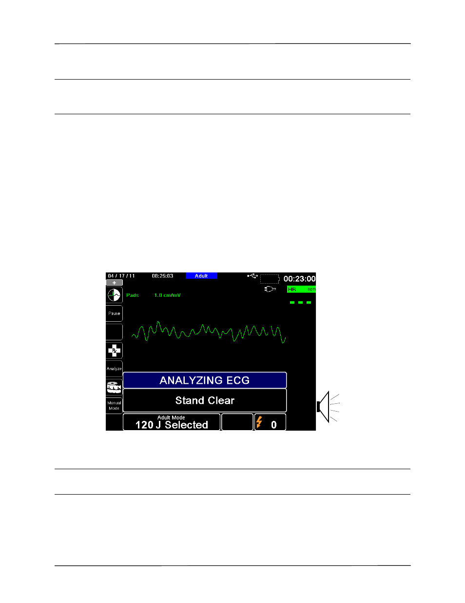 2 analyze | ZOLL Propaq MD Rev C User Manual | Page 165 / 326