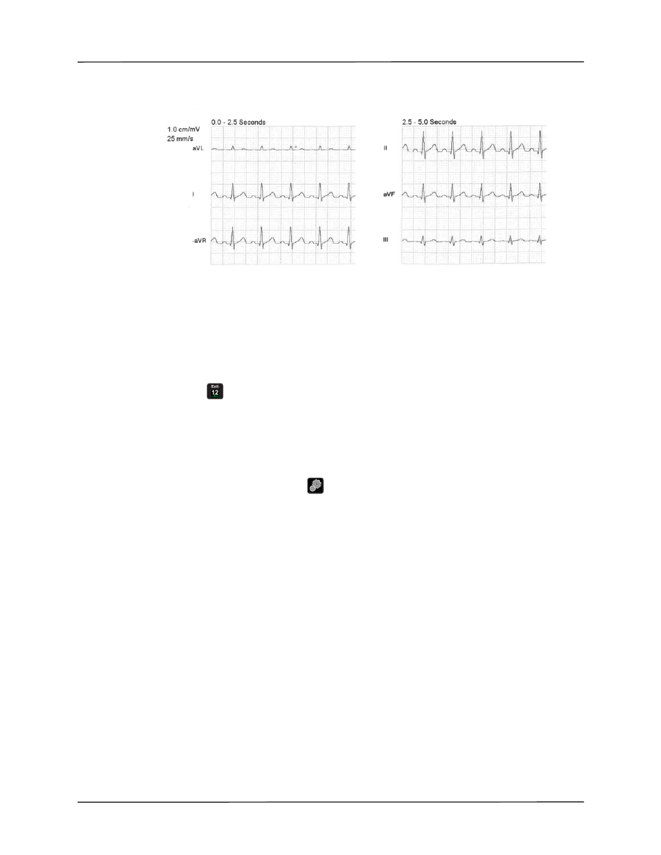 Lead print and display options | ZOLL Propaq MD Rev C User Manual | Page 183 / 326