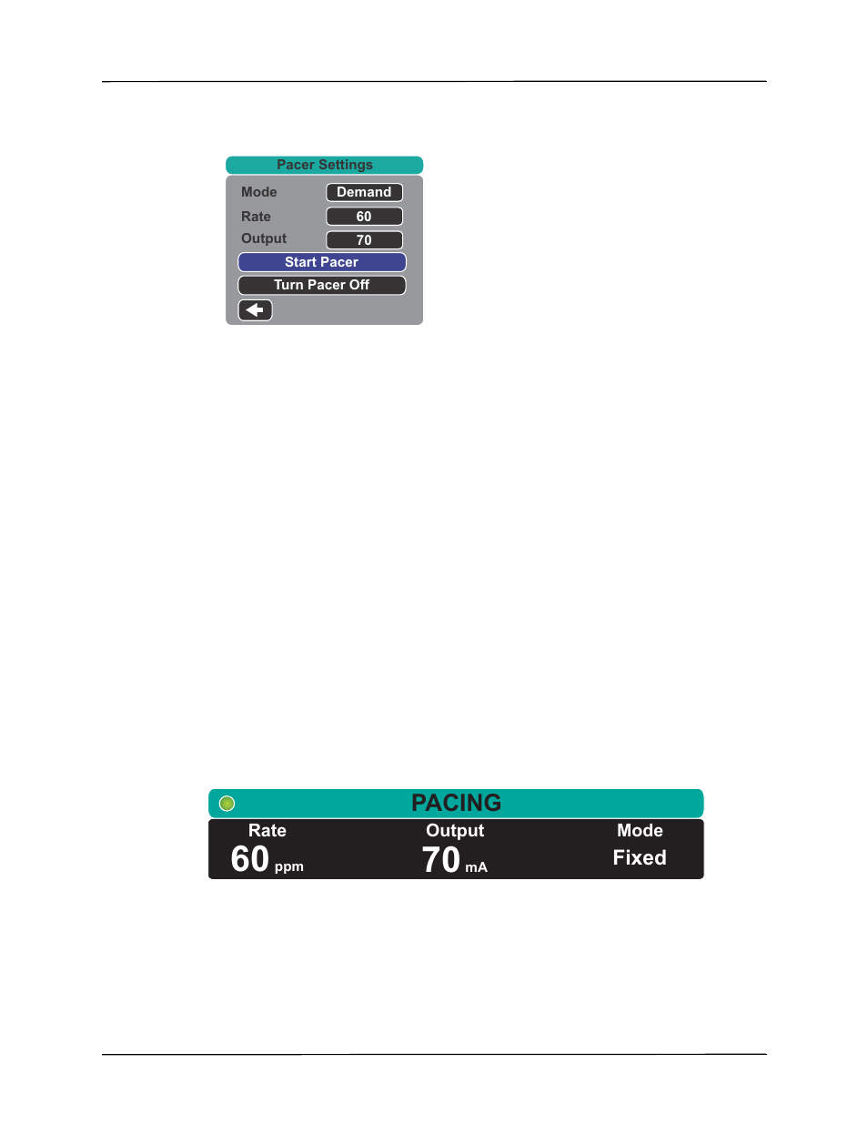 Pacing, Fixed | ZOLL Propaq MD Rev C User Manual | Page 219 / 326