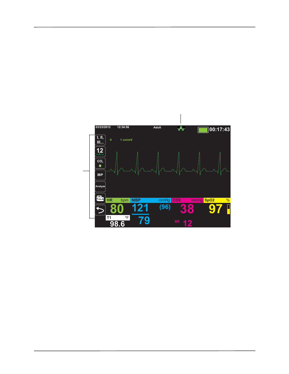 ZOLL Propaq MD Rev C User Manual | Page 45 / 326