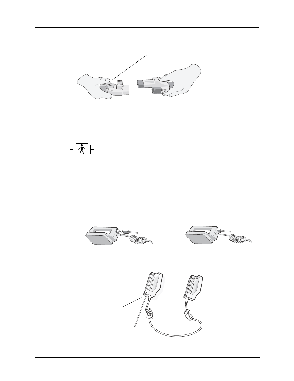 External paddles | ZOLL Propaq MD Rev C User Manual | Page 50 / 326