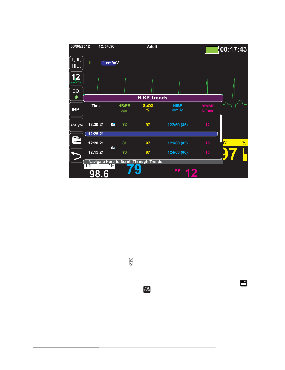 Displaying and printing trend information | ZOLL Propaq MD Rev C User Manual | Page 72 / 326