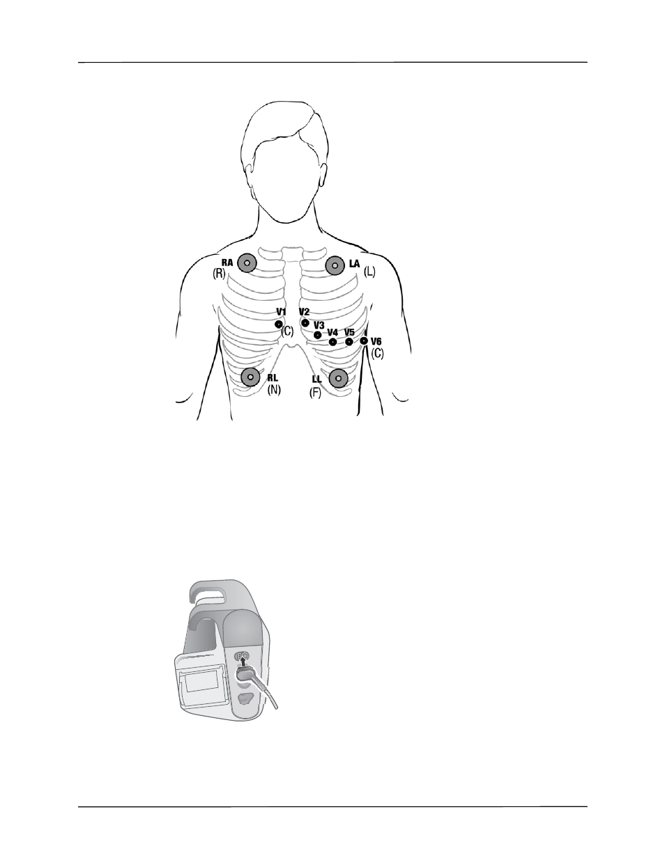 Connecting the ecg cable to the propaq md unit | ZOLL Propaq MD Rev C User Manual | Page 89 / 326