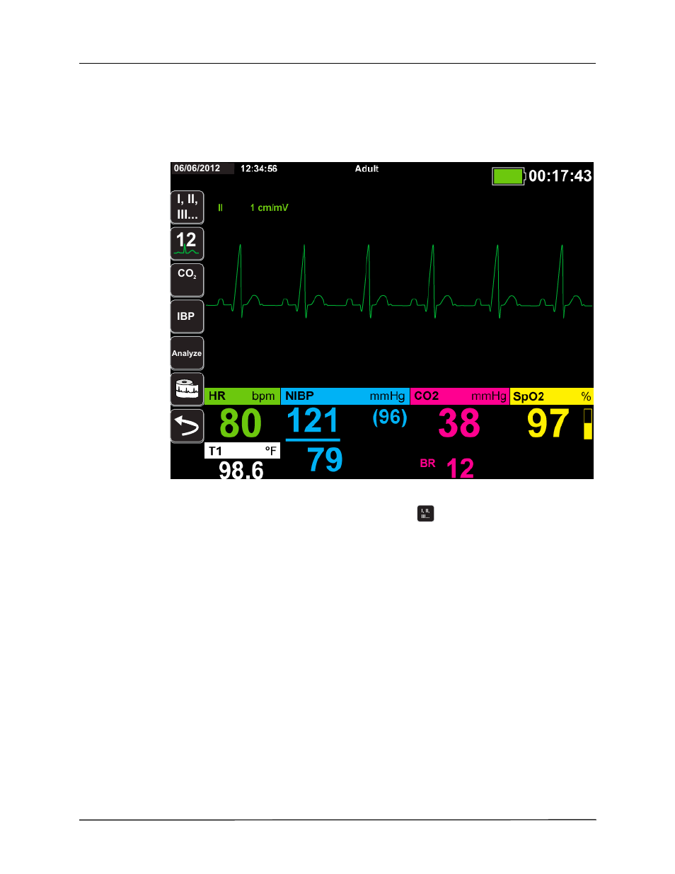 Selecting ecg waveforms for display | ZOLL Propaq MD Rev C User Manual | Page 90 / 326