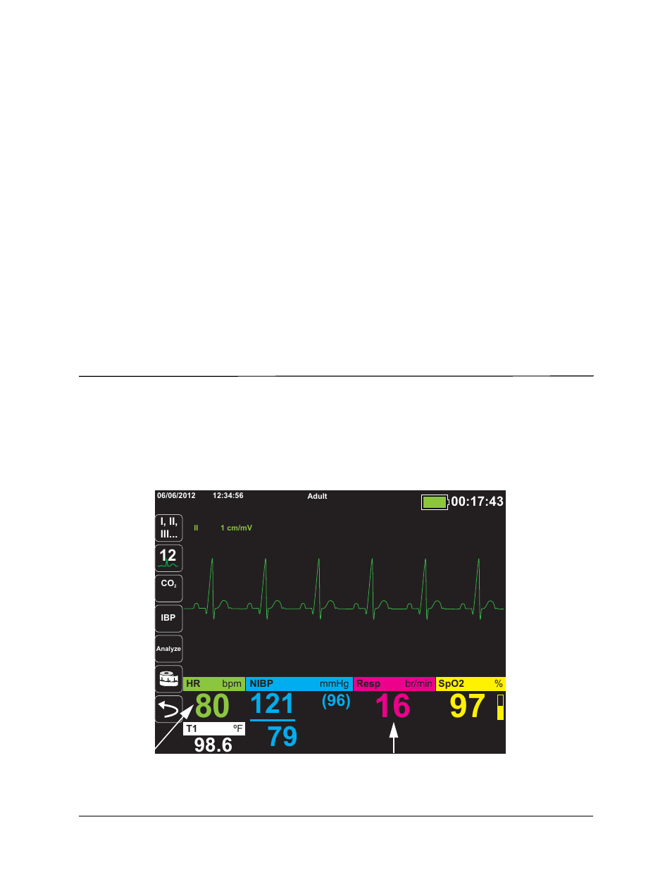Chapter 7, Monitoring respiration (resp) and heart rate (hr) | ZOLL Propaq MD Rev C User Manual | Page 95 / 326