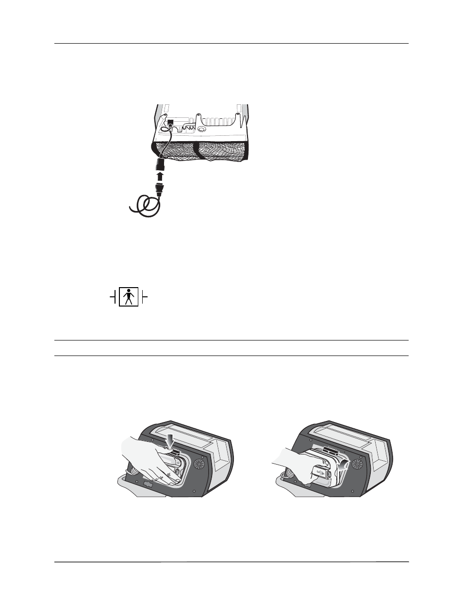 External paddles (manual mode only) | ZOLL R Series Monitor Defibrillator Rev J User Manual | Page 206 / 538