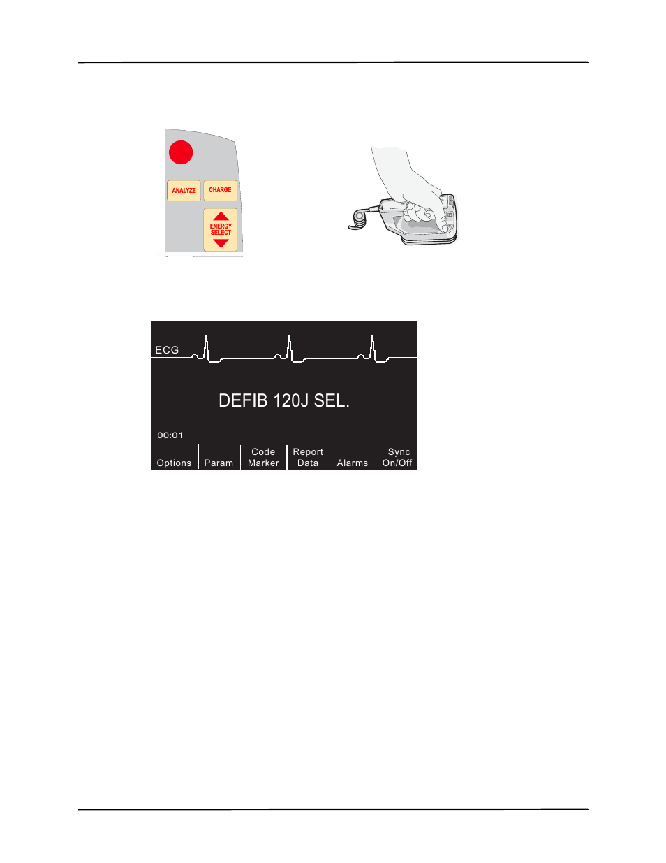 Defib 120j sel | ZOLL R Series Monitor Defibrillator Rev J User Manual | Page 227 / 538