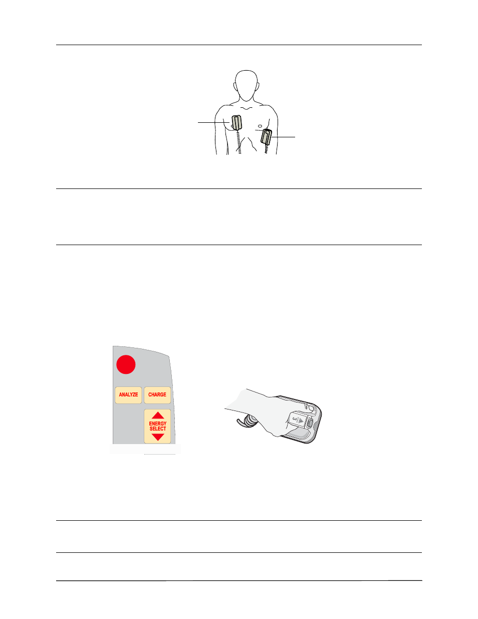 2 charge defibrillator | ZOLL R Series Monitor Defibrillator Rev J User Manual | Page 228 / 538