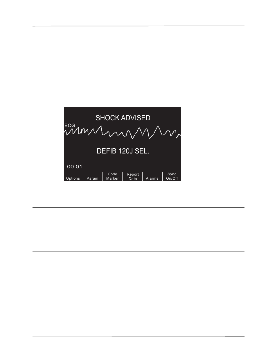 Defib 120j sel, Shock advised, 3 press shock | ZOLL R Series Monitor Defibrillator Rev J User Manual | Page 241 / 538