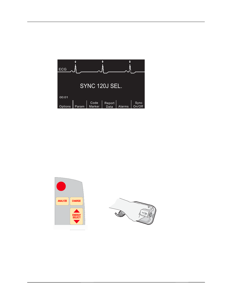 Sync 120j sel, 2 charge defibrillator | ZOLL R Series Monitor Defibrillator Rev J User Manual | Page 248 / 538