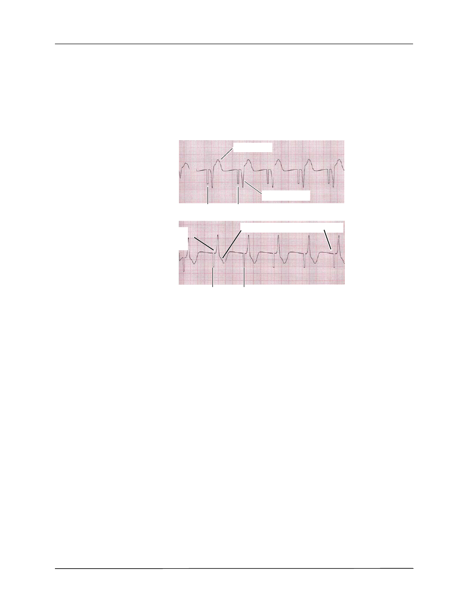 6 determine optimum threshold | ZOLL R Series Monitor Defibrillator Rev J User Manual | Page 268 / 538