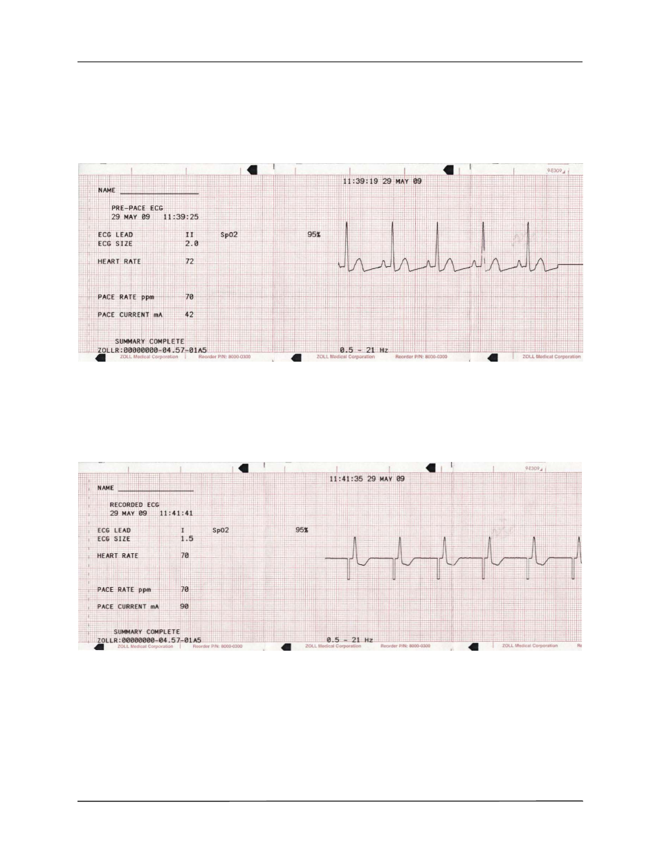 ZOLL R Series Monitor Defibrillator Rev J User Manual | Page 288 / 538
