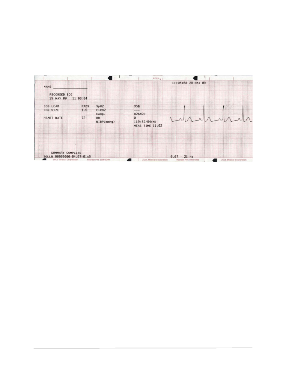 ZOLL R Series Monitor Defibrillator Rev J User Manual | Page 290 / 538