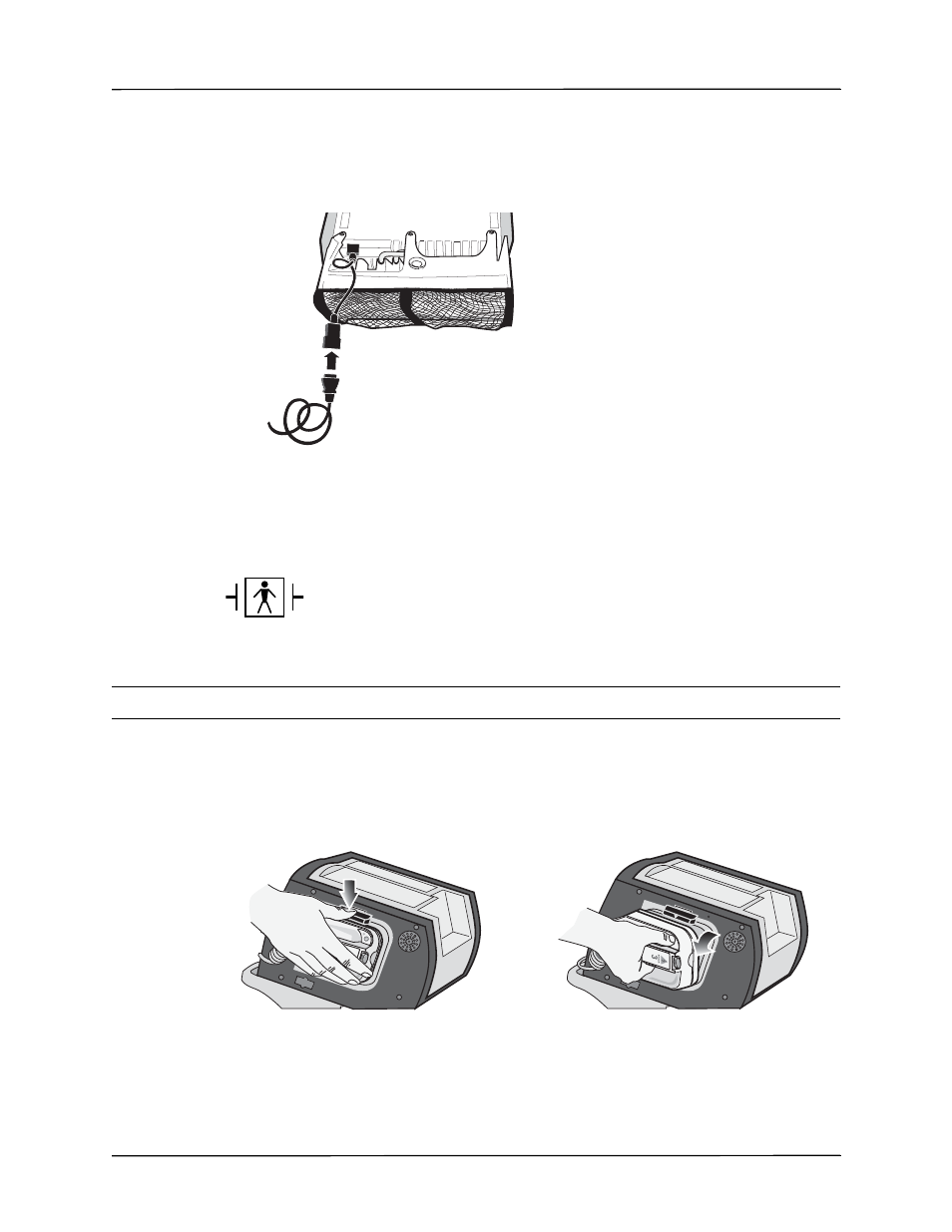 External paddles | ZOLL R Series Monitor Defibrillator Rev J User Manual | Page 401 / 538