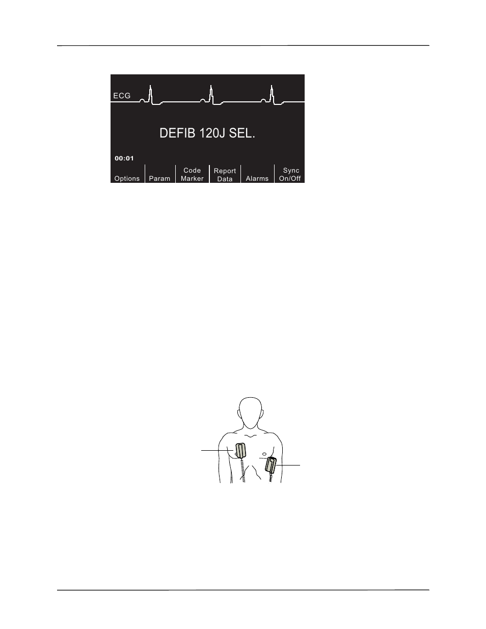 Defib 120j sel | ZOLL R Series Monitor Defibrillator Rev J User Manual | Page 409 / 538