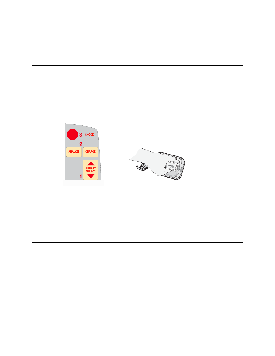 2 charge defibrillator | ZOLL R Series Monitor Defibrillator Rev J User Manual | Page 410 / 538