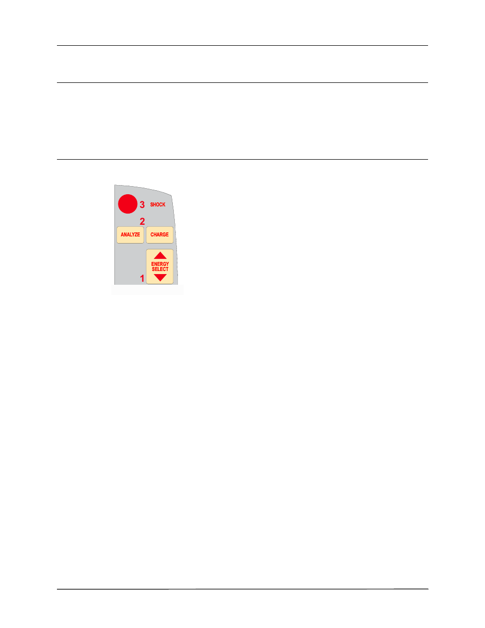 Autoclavable electrodes, 3 deliver shock | ZOLL R Series Monitor Defibrillator Rev J User Manual | Page 416 / 538