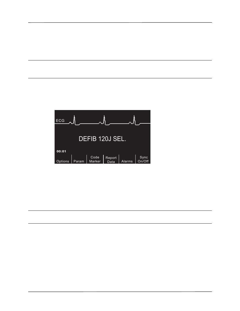 Defib 120j sel, 2 press analyze button | ZOLL R Series Monitor Defibrillator Rev J User Manual | Page 419 / 538