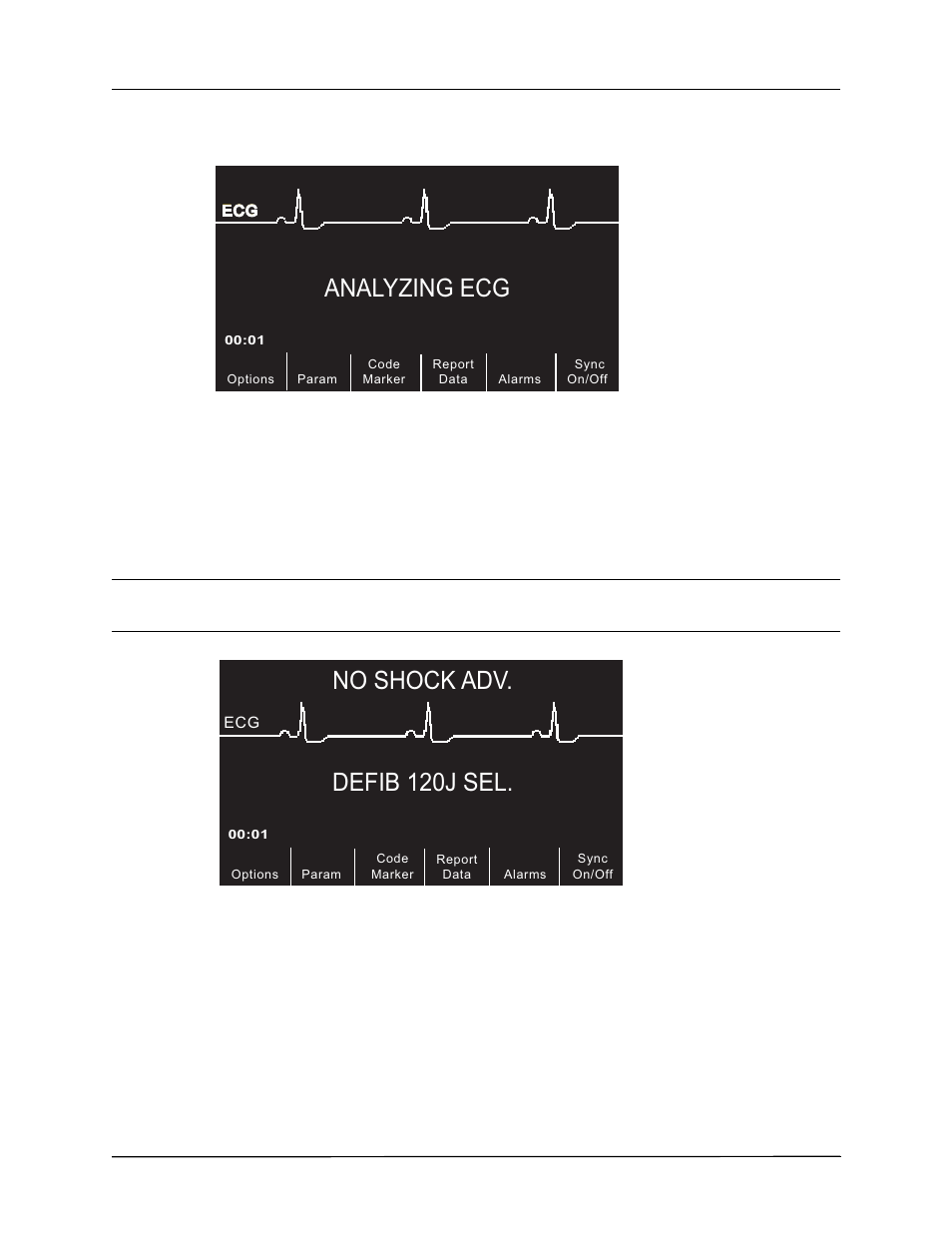 Analyzing ecg, Defib 120j sel, No shock adv | ZOLL R Series Monitor Defibrillator Rev J User Manual | Page 420 / 538