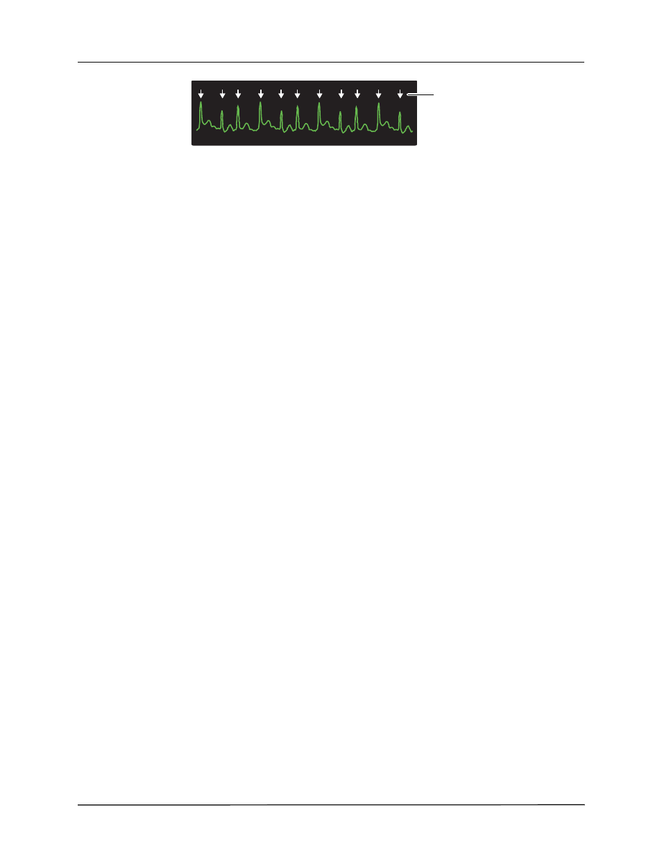 Synchronized cardioversion procedure | ZOLL R Series Monitor Defibrillator Rev J User Manual | Page 426 / 538