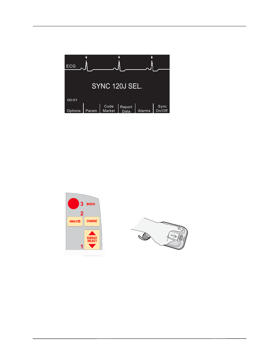 Sync 120j sel, 2 charge defibrillator | ZOLL R Series Monitor Defibrillator Rev J User Manual | Page 428 / 538