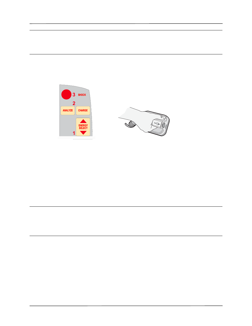 2 charge defibrillator, 3 deliver shock | ZOLL R Series Monitor Defibrillator Rev J User Manual | Page 431 / 538
