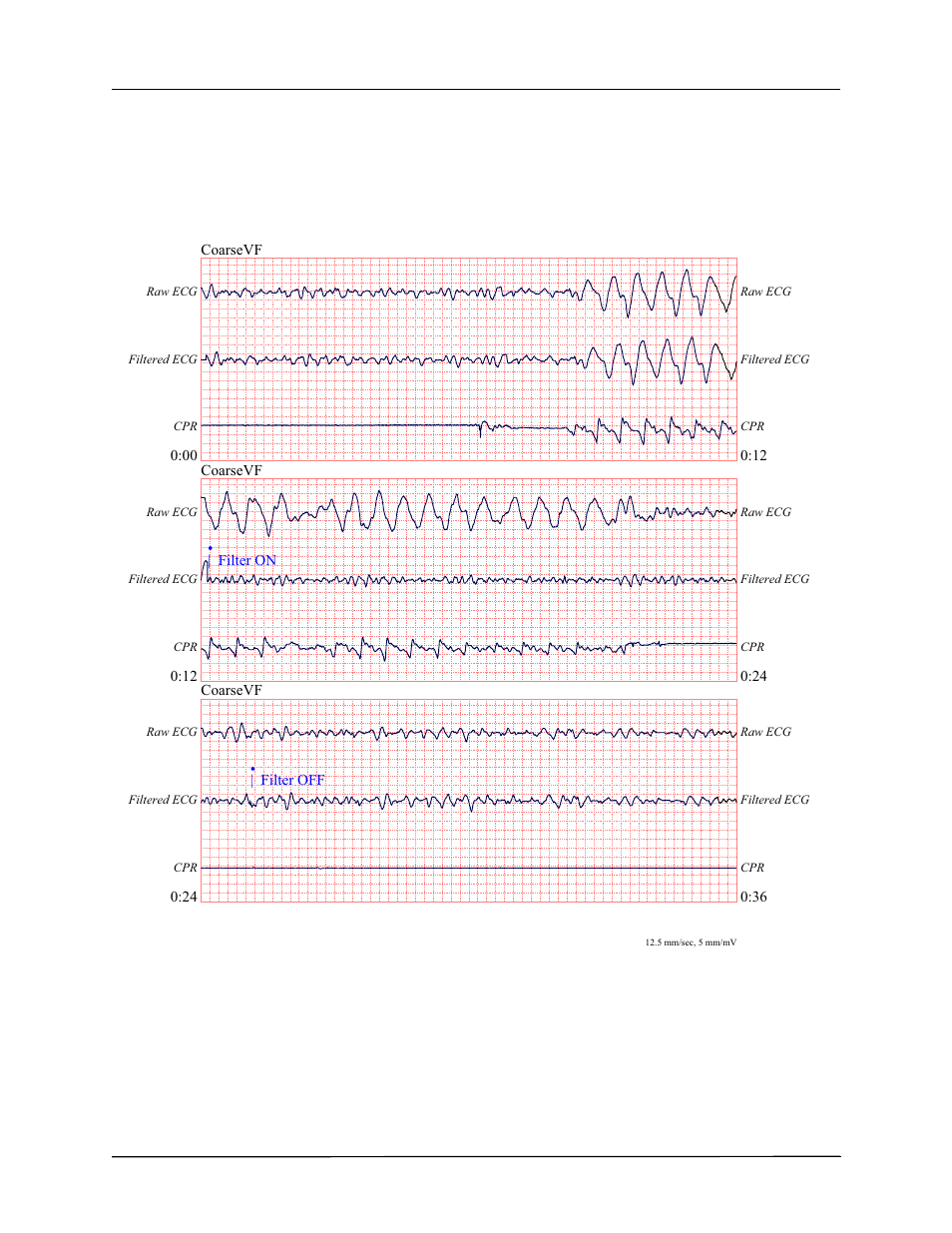 ZOLL R Series Monitor Defibrillator Rev J User Manual | Page 440 / 538