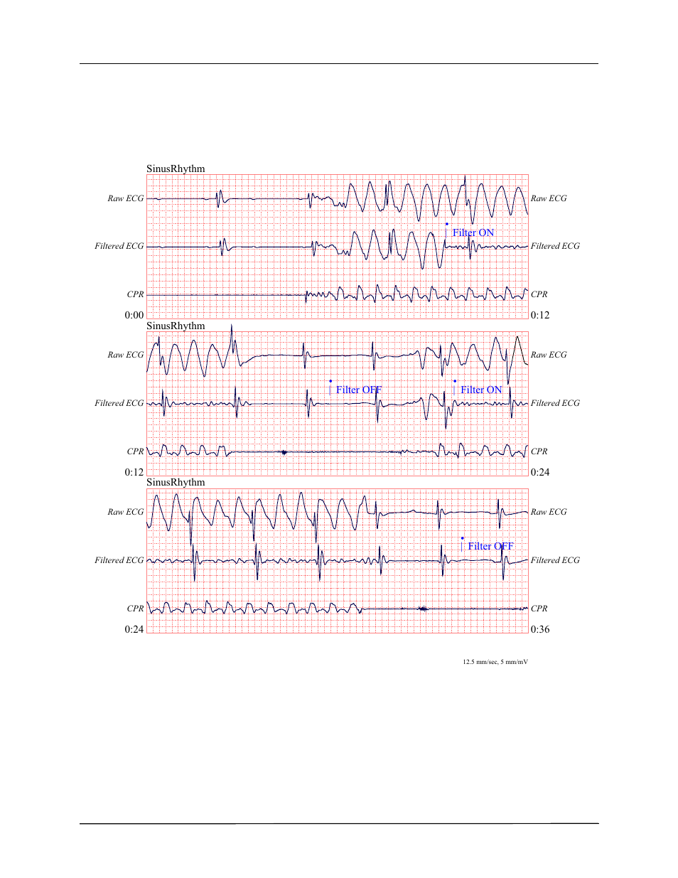 ZOLL R Series Monitor Defibrillator Rev J User Manual | Page 442 / 538