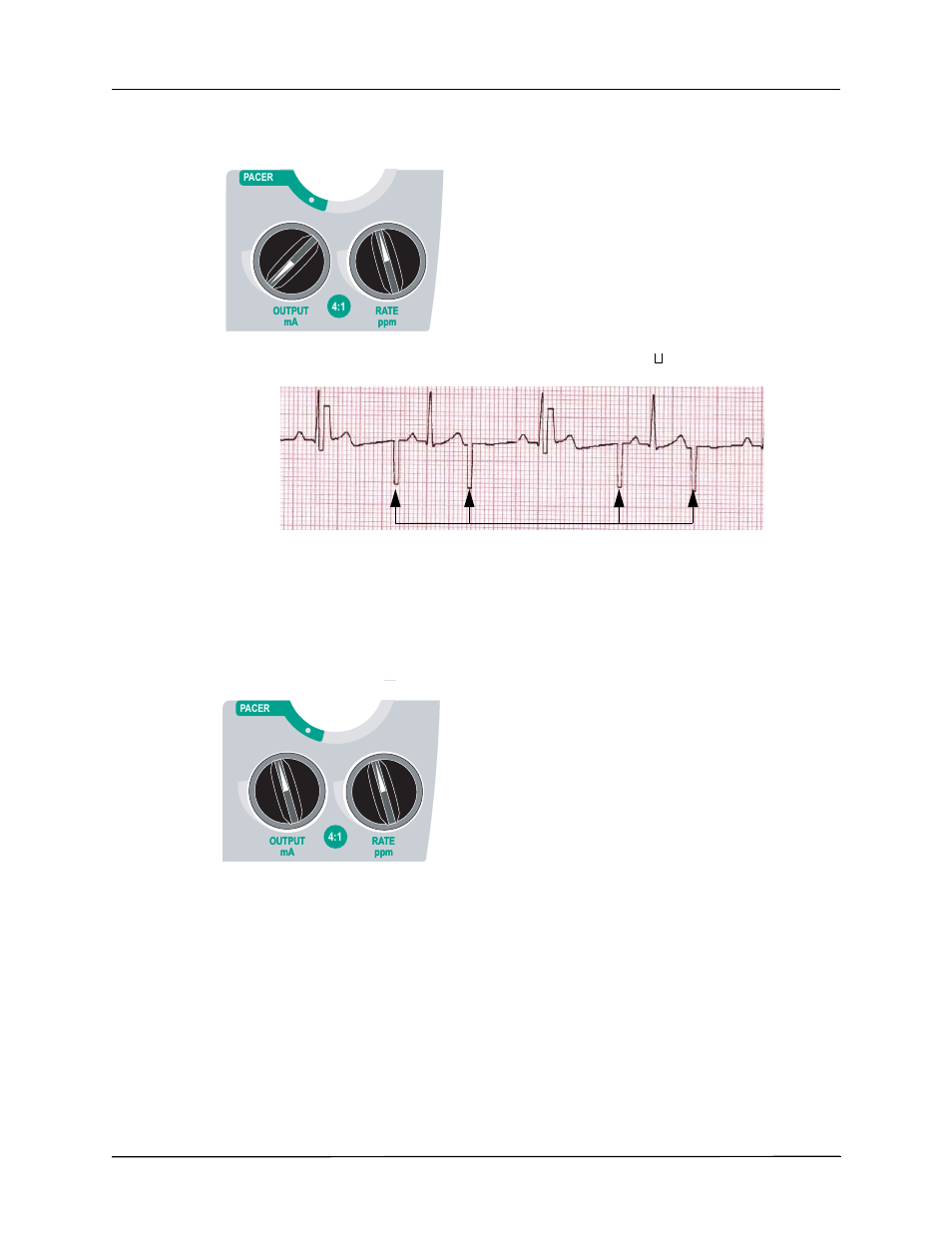 4 set pacer output | ZOLL R Series Monitor Defibrillator Rev J User Manual | Page 446 / 538
