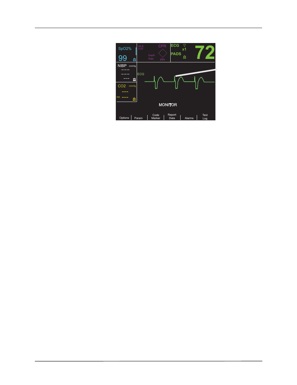 Lead monitoring | ZOLL R Series Monitor Defibrillator Rev J User Manual | Page 456 / 538
