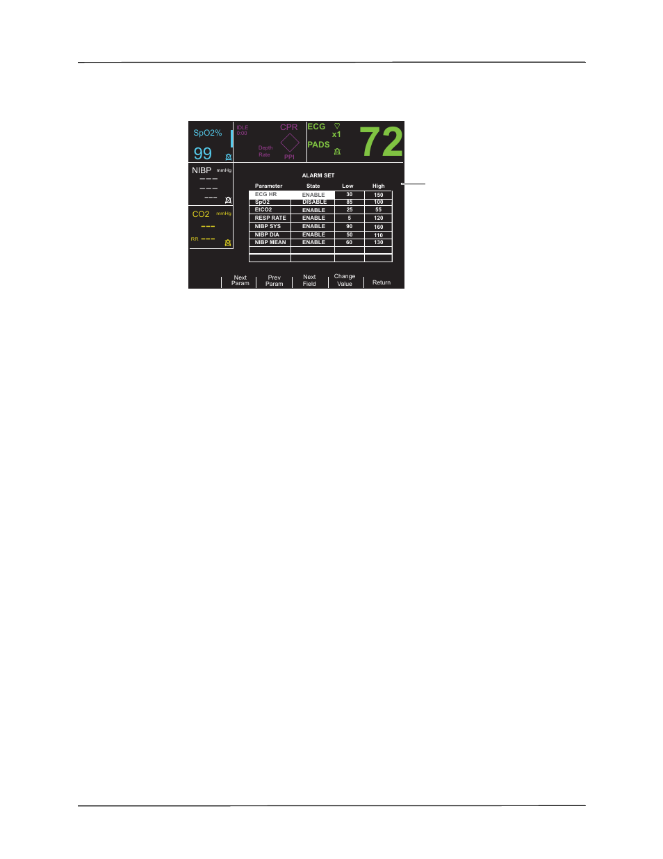 Heart rate alarm limits, Alarms | ZOLL R Series Monitor Defibrillator Rev J User Manual | Page 459 / 538
