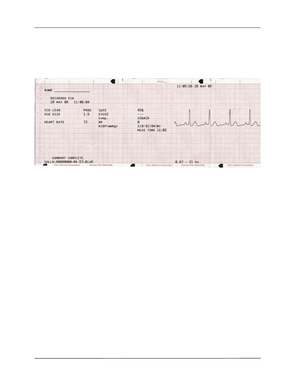 ZOLL R Series Monitor Defibrillator Rev J User Manual | Page 468 / 538