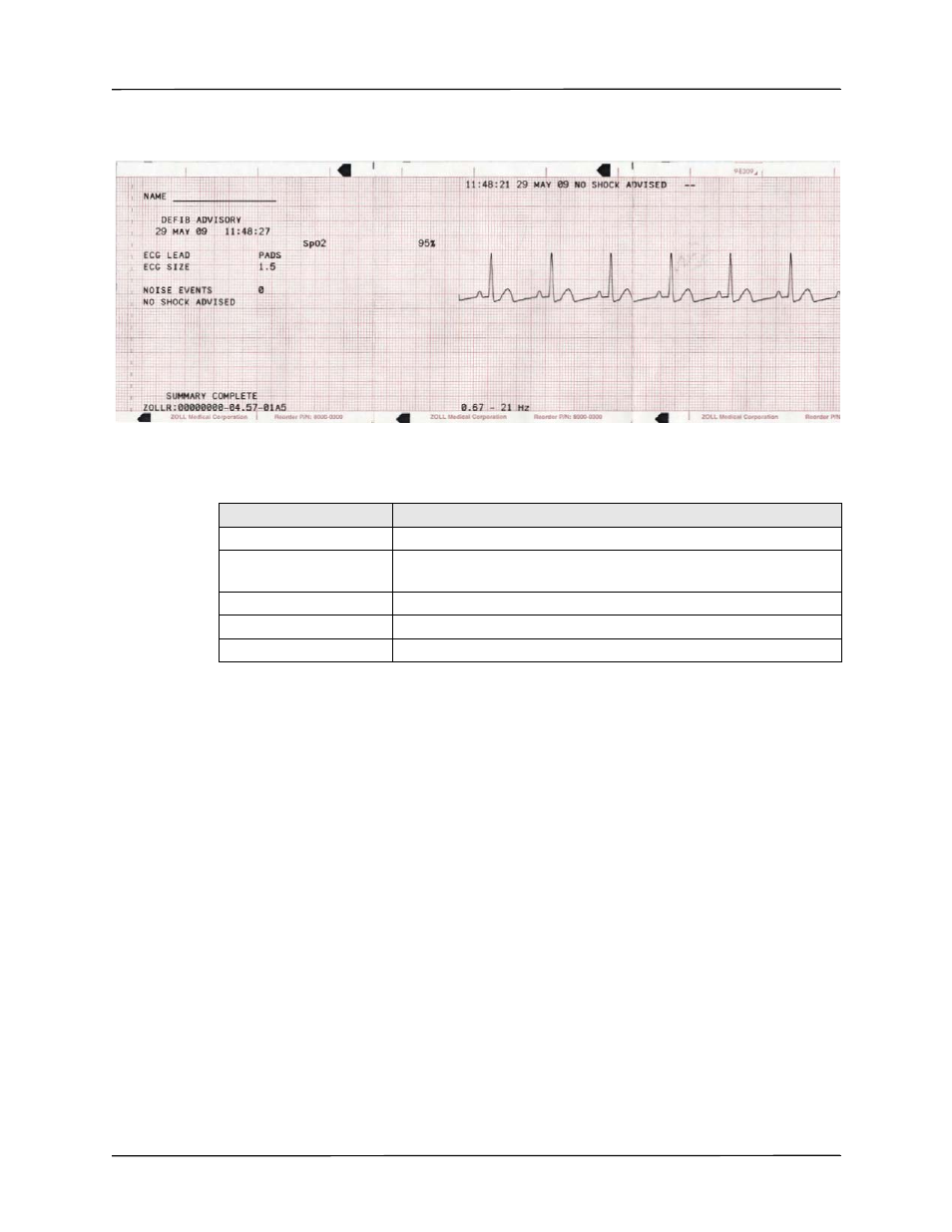 Printing the entire summary report | ZOLL R Series Monitor Defibrillator Rev J User Manual | Page 469 / 538