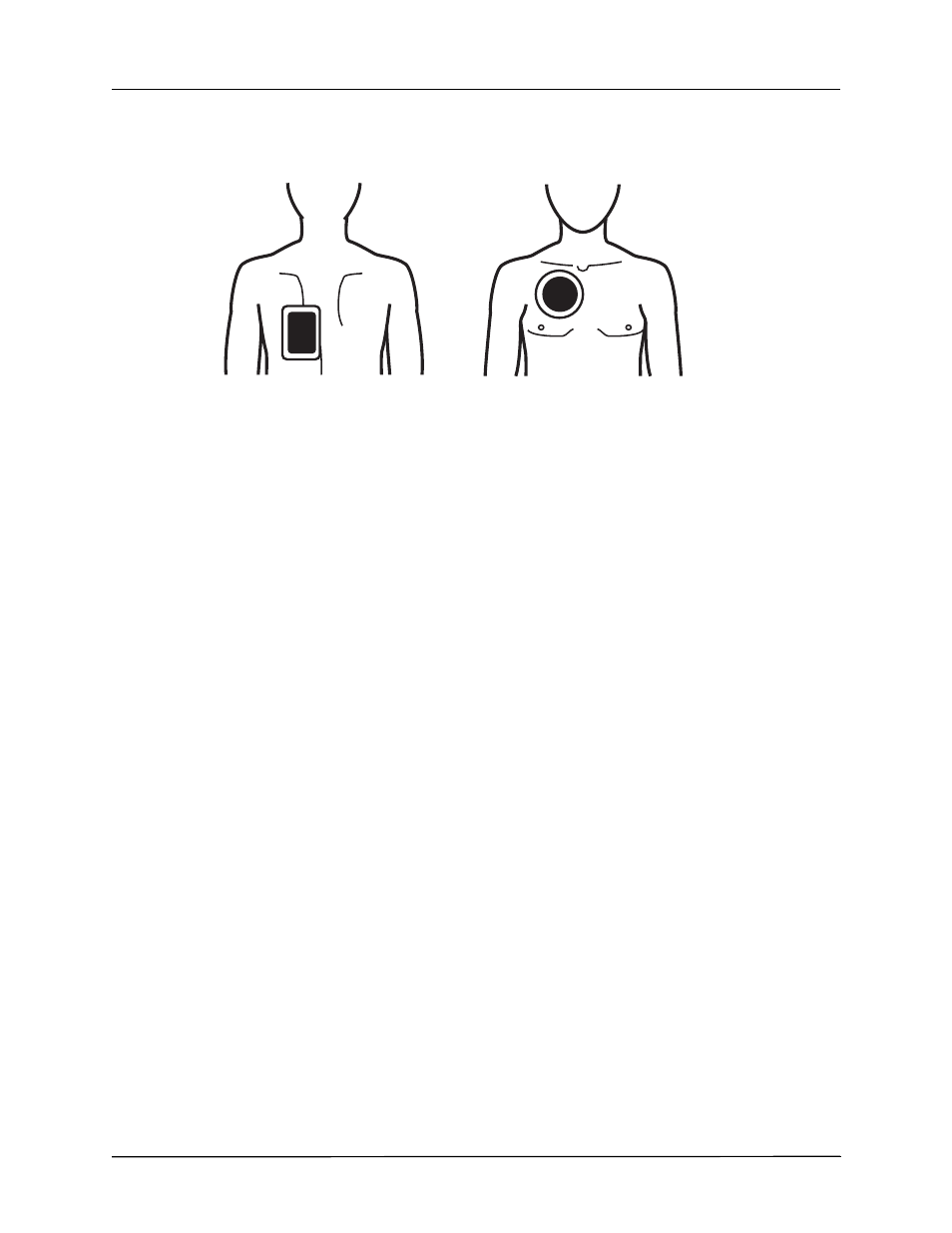 ZOLL R Series Monitor Defibrillator Rev J User Manual | Page 530 / 538