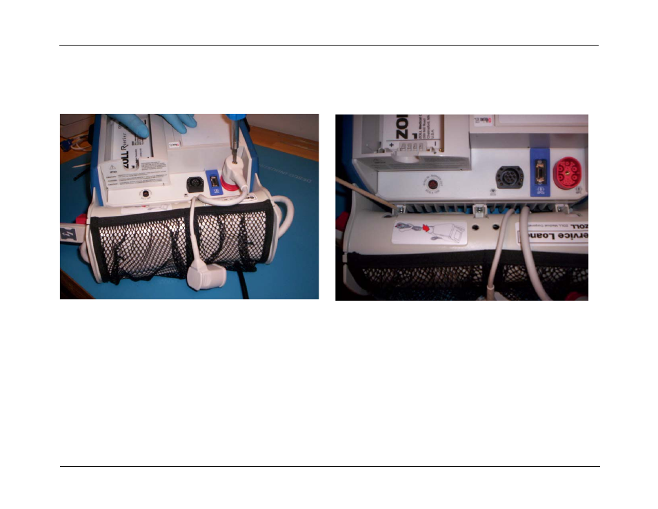 Removing the cable caddy, Removing the cable caddy -3 | ZOLL R Series Monitor Defibrillator Rev J User Manual | Page 69 / 538