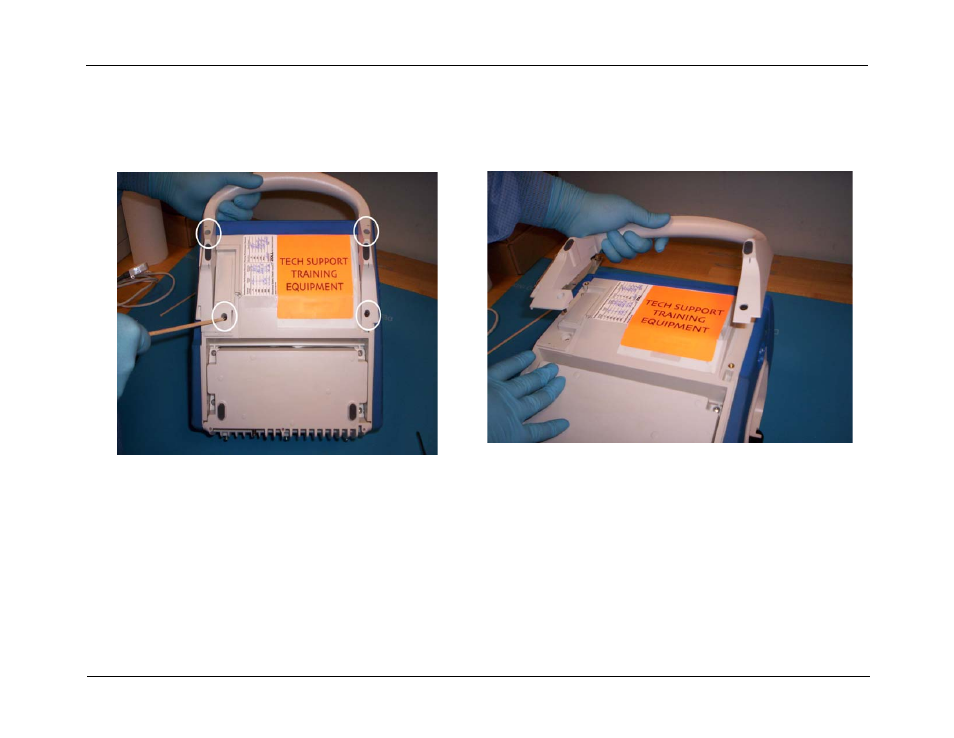 Removing the handle, Removing the handle -6 | ZOLL R Series Monitor Defibrillator Rev J User Manual | Page 72 / 538
