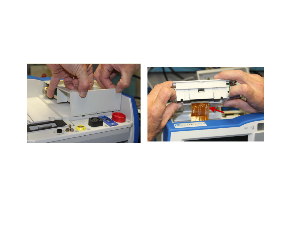 ZOLL R Series Monitor Defibrillator Rev J User Manual | Page 77 / 538